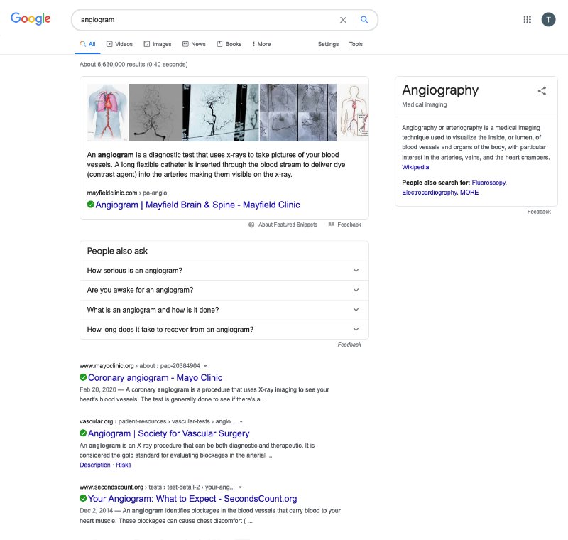 Angiogram Google Search